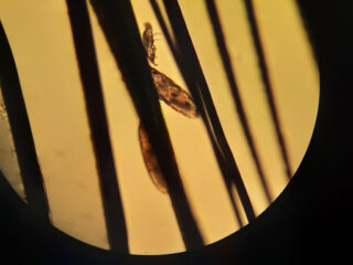 Caso clínico cobayas. Imagen de ácaros en el microscopio.