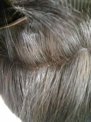 Caso clínico cobayas. Imagen de piojos en el pelo.