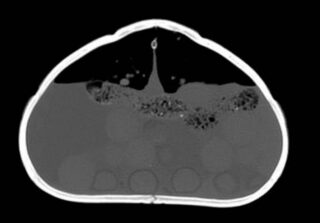 Resultado TAC tortuga transversal donde se ven estructuras grises en pulmón y folí­culos preovulatorios redondos tocando al peto